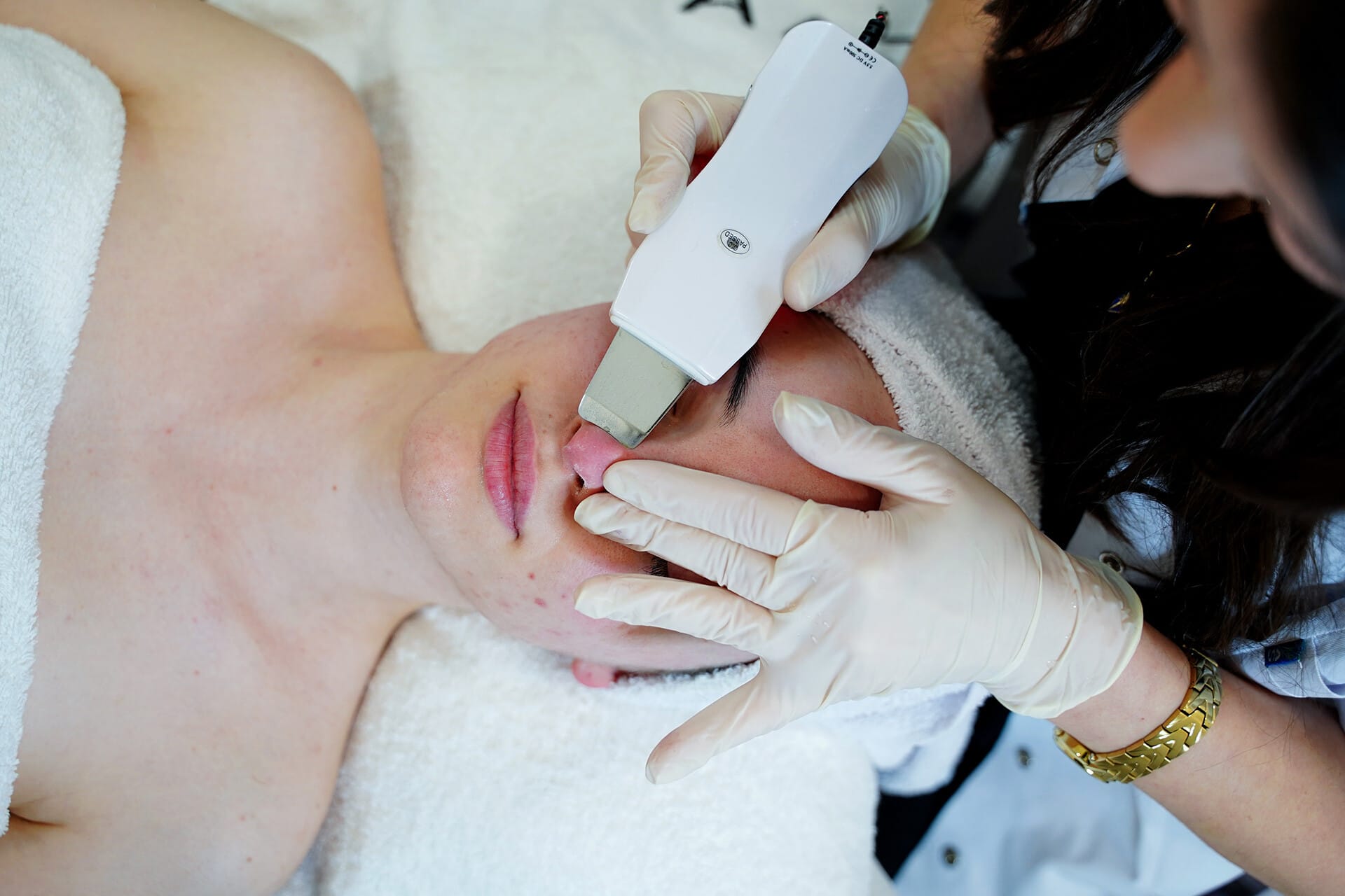 Skin cleansing and peeling with an ultrasonic spatula