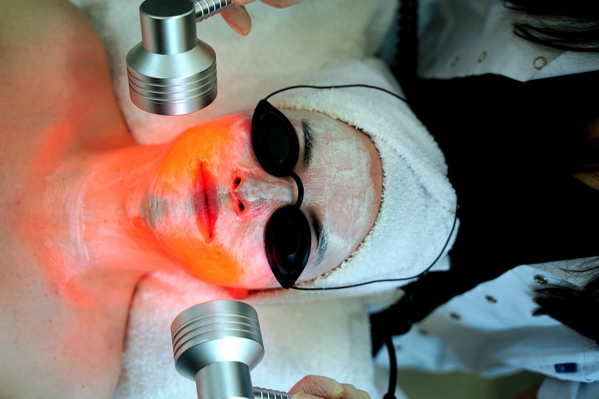 Infrared light therapy with protective goggles during a mask treatment