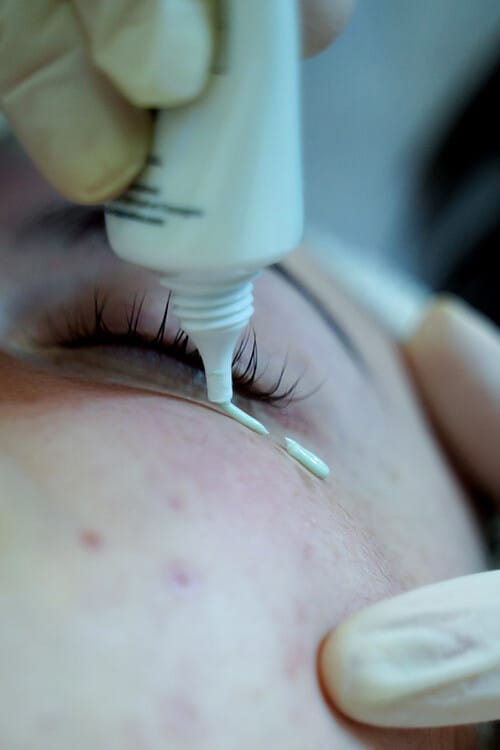 Treatment cream being applied point by point after a facial
